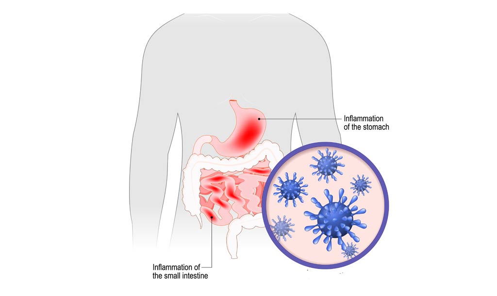 foodillness_foodsafety